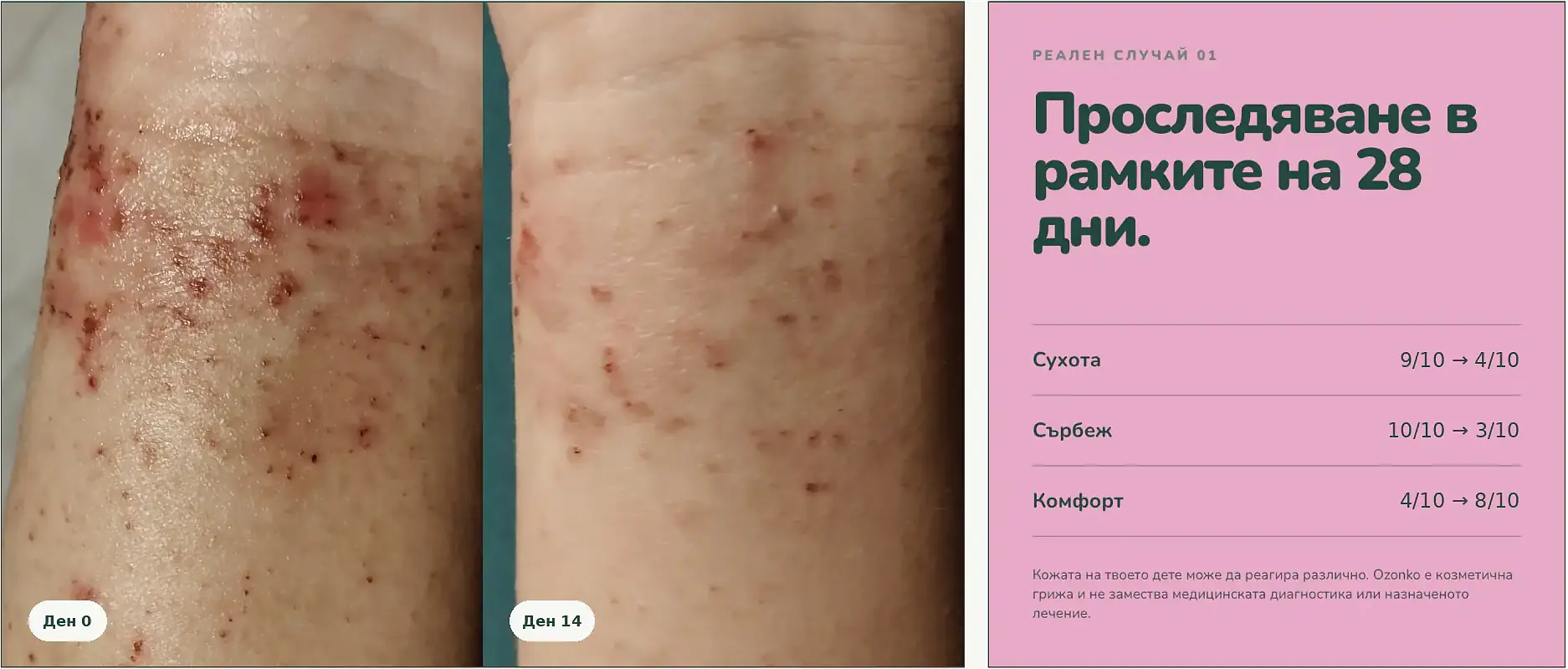 Ozonko реален резултат 3