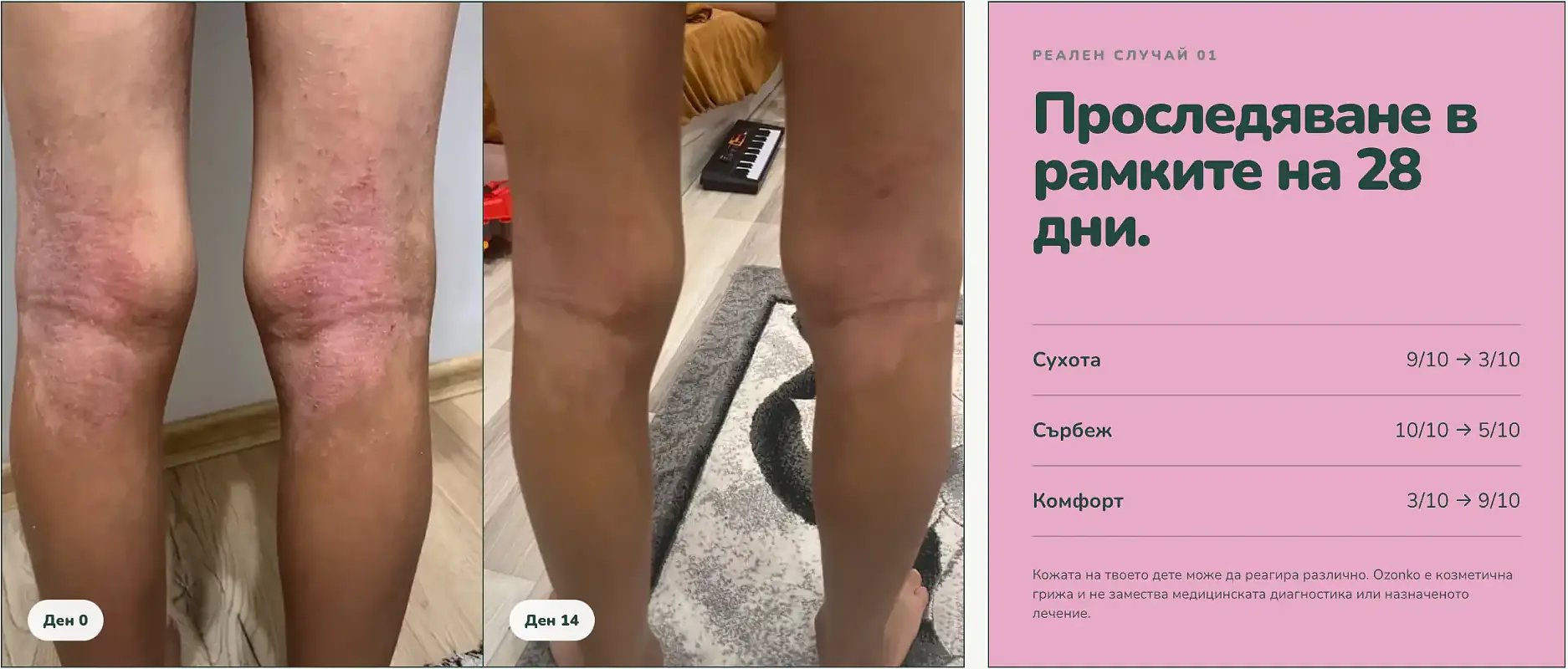 Ozonko реален резултат 1