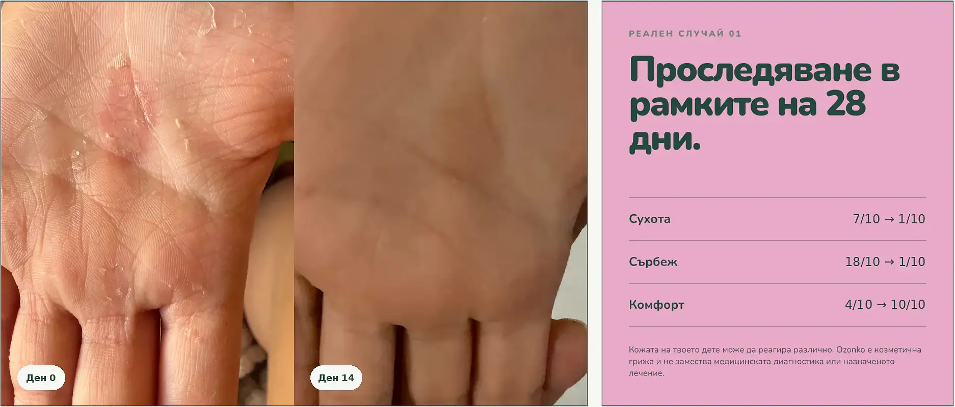 Ozonko реален резултат 2